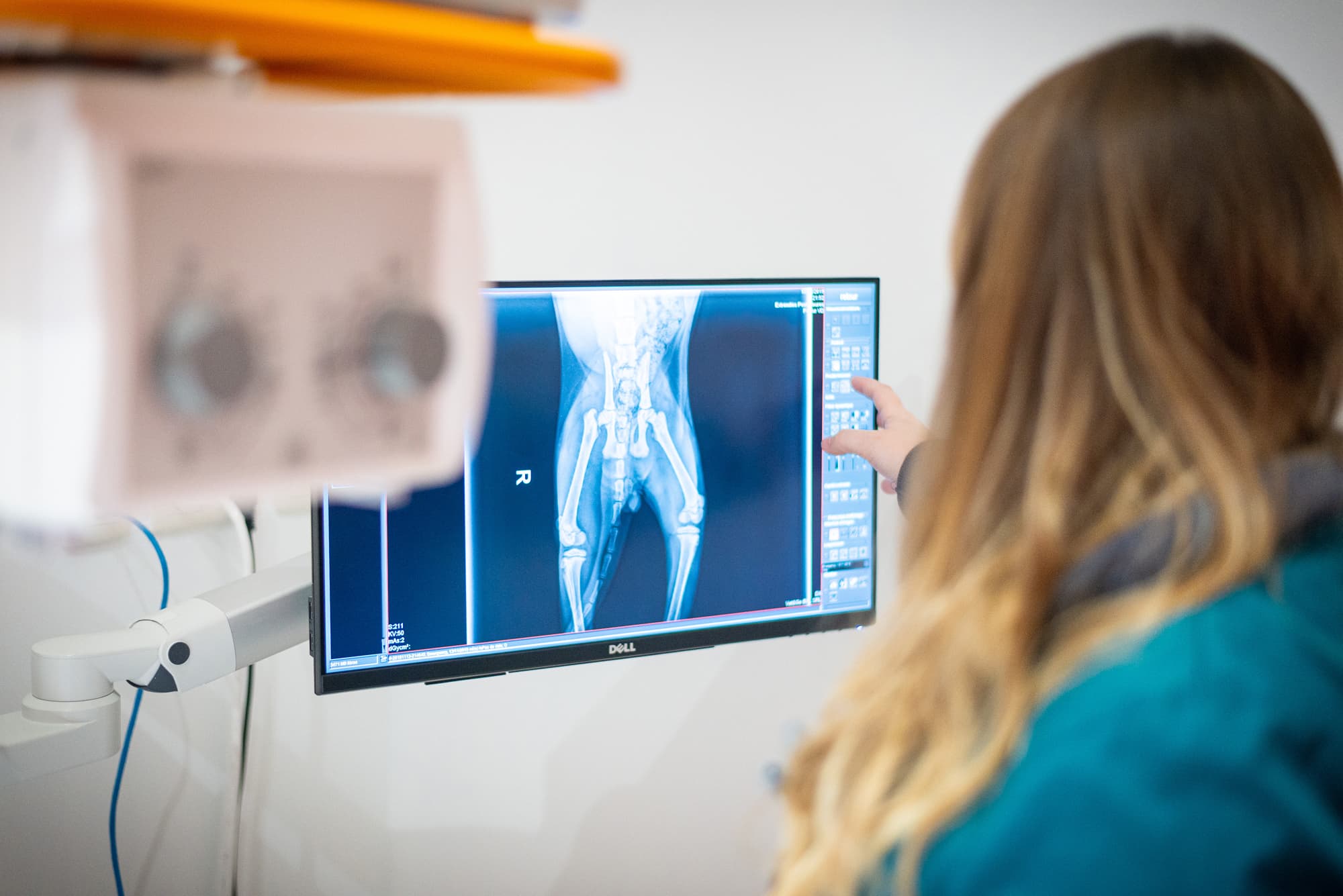 radiographie